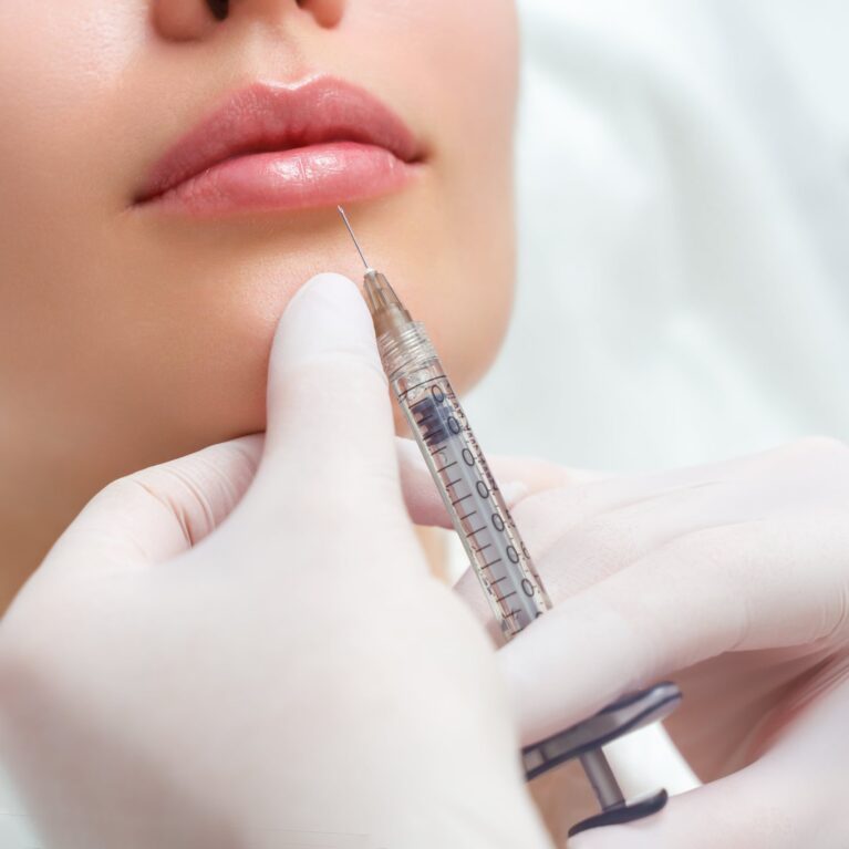 Dermal Fillers